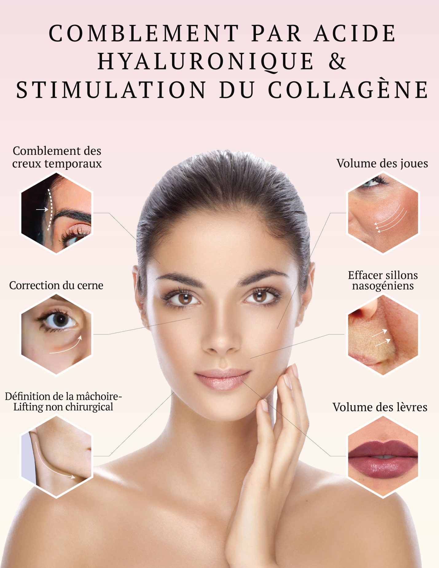 Médecine Esthétique Du Visage Brussels Smile Clinic